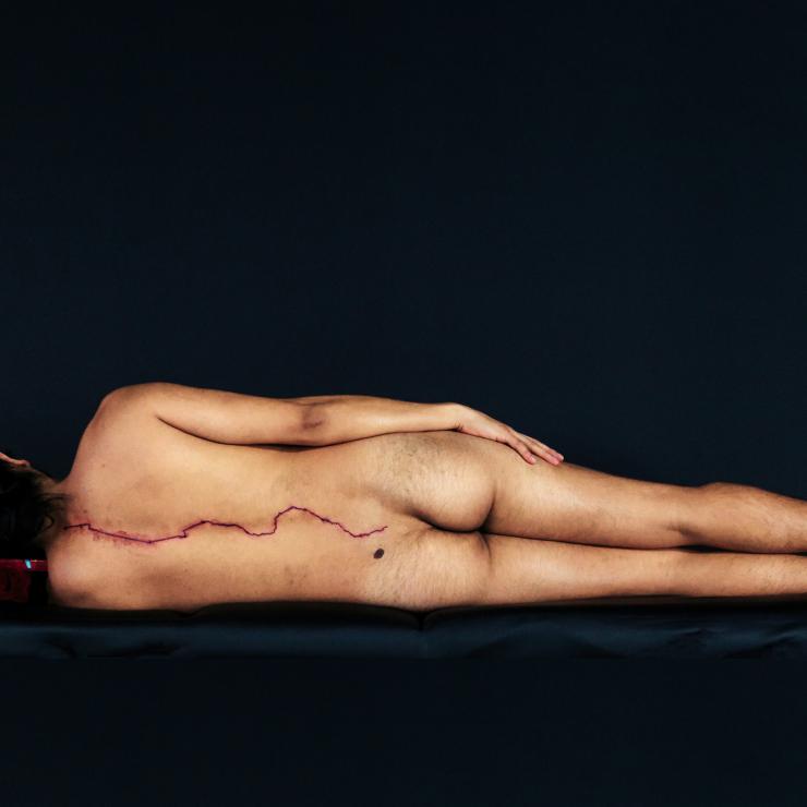 Photo by Emilio Rojas, Heridas Abiertas (to Gloria), 2014–ongoing. Digital photograph of a naked body facing away from the camera, lying on its side.