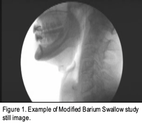 X-ray of someone jaw and neck
